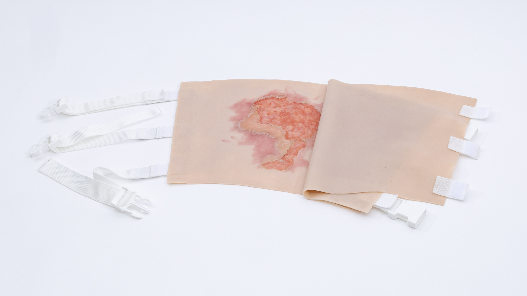 Thigh TraumaWear Scalding Burn Set - Image 6