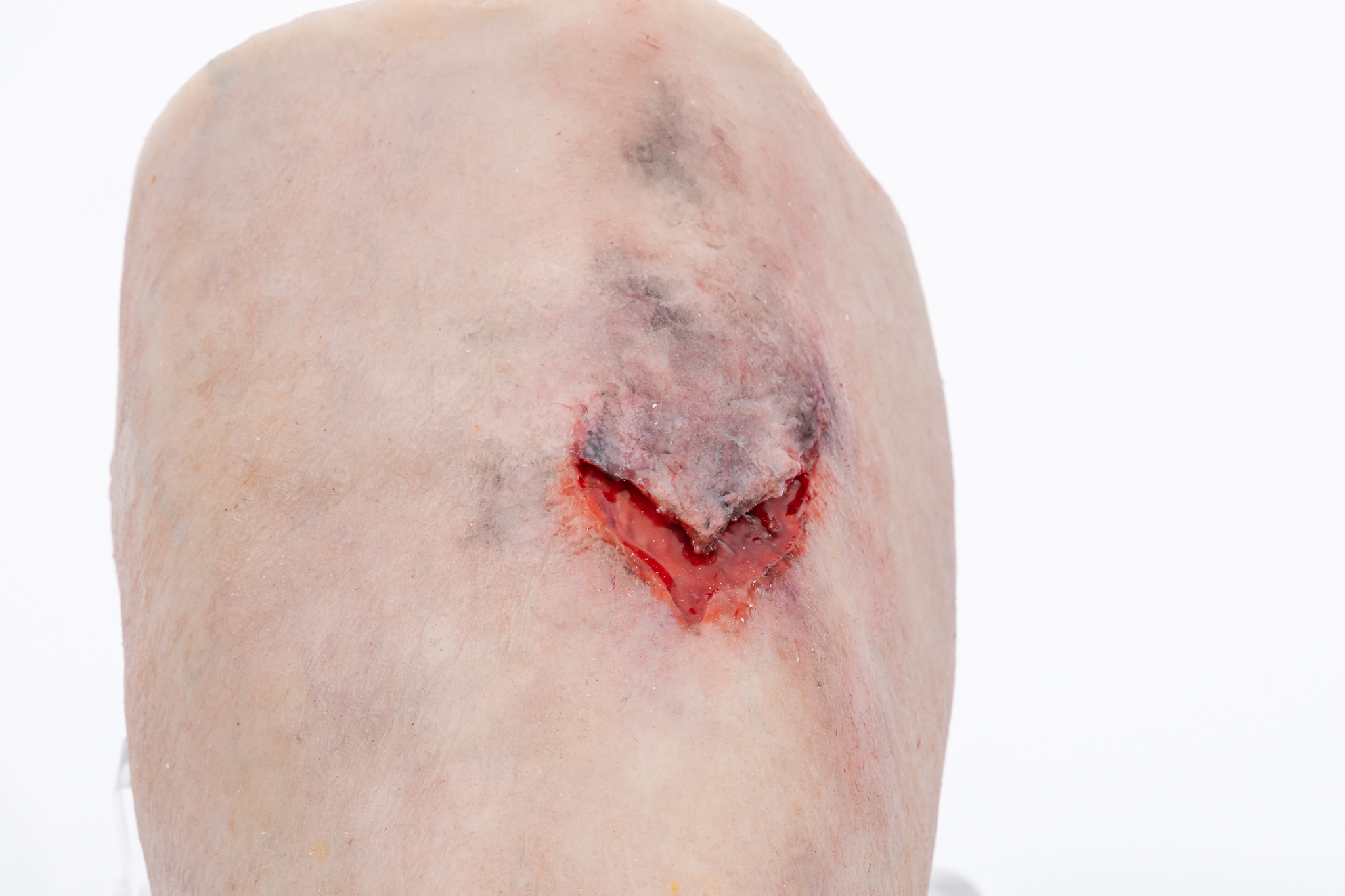 Lifecast Elderly Leg with Chronic Wounds - Image 12