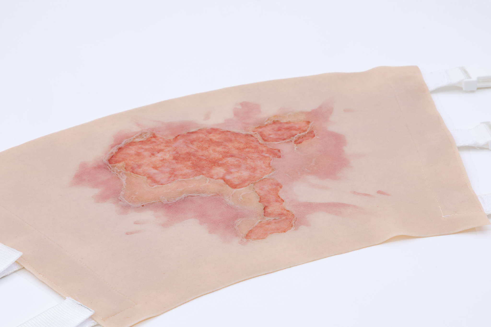 Thigh TraumaWear Scalding Burn Set - Image 7