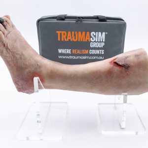 Lifecast Elderly Leg with Chronic Wounds