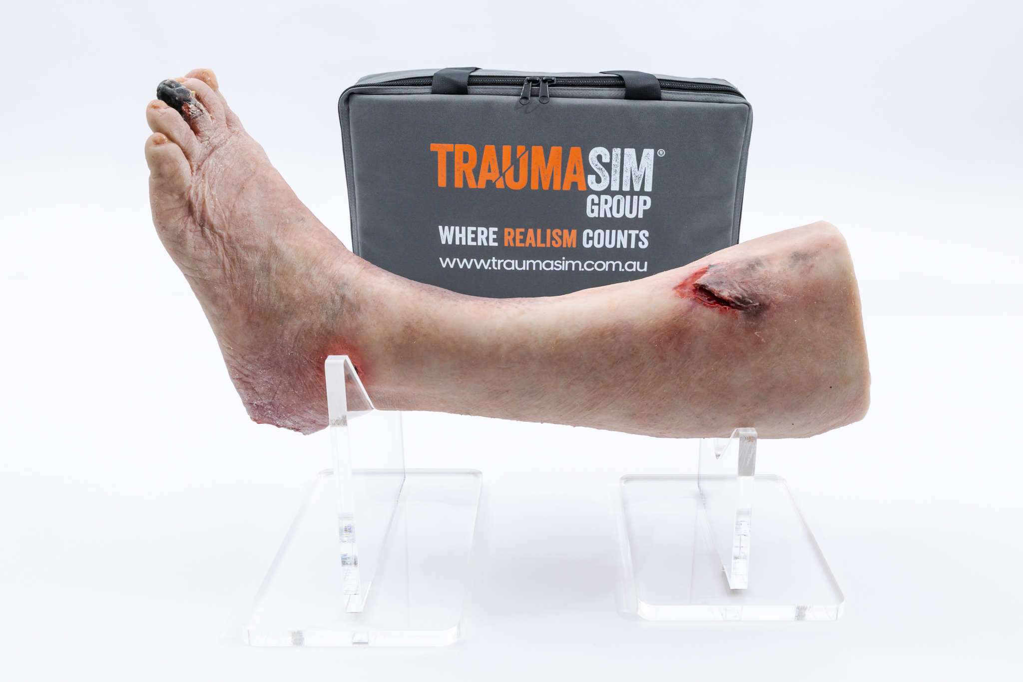 Lifecast Elderly Leg with Chronic Wounds