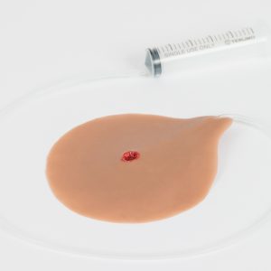 Gunshot Wound 7.62 mm Entry with Bleeding Capacity