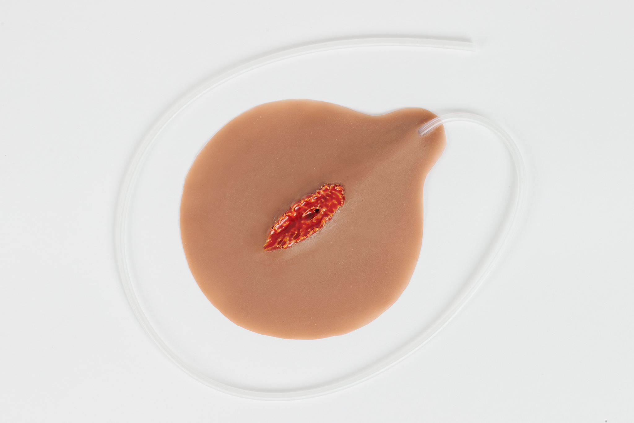 Open Laceration with Bleeding Capacity - Image 4
