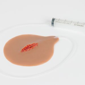 Open Laceration with Bleeding Capacity