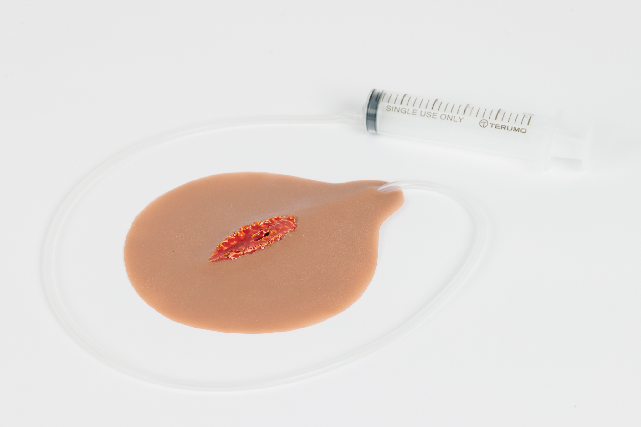 Open Laceration with Bleeding Capacity