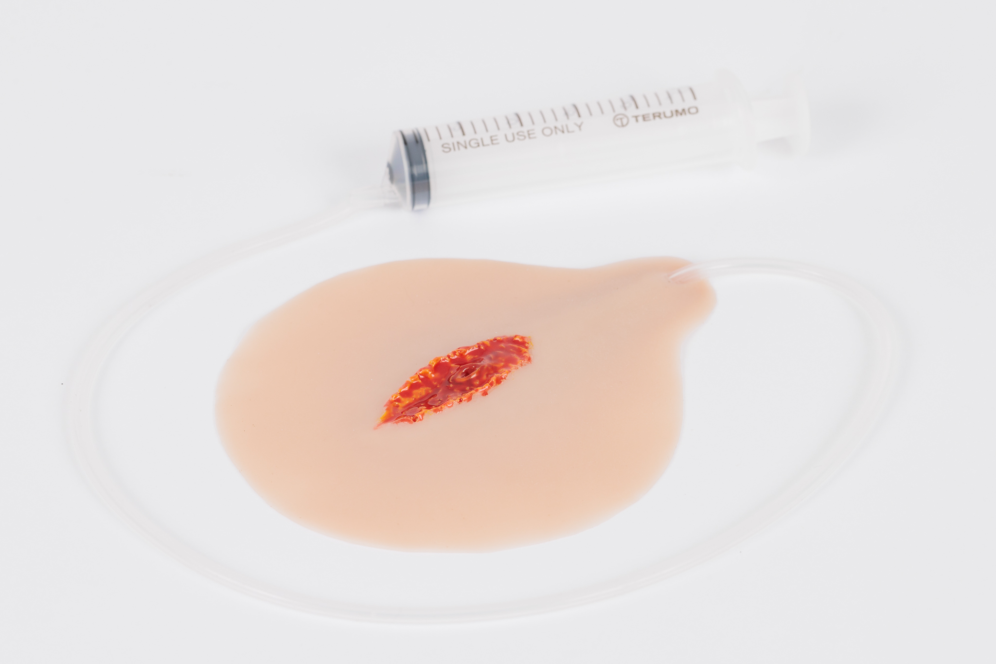 Open Laceration with Bleeding Capacity - Image 2