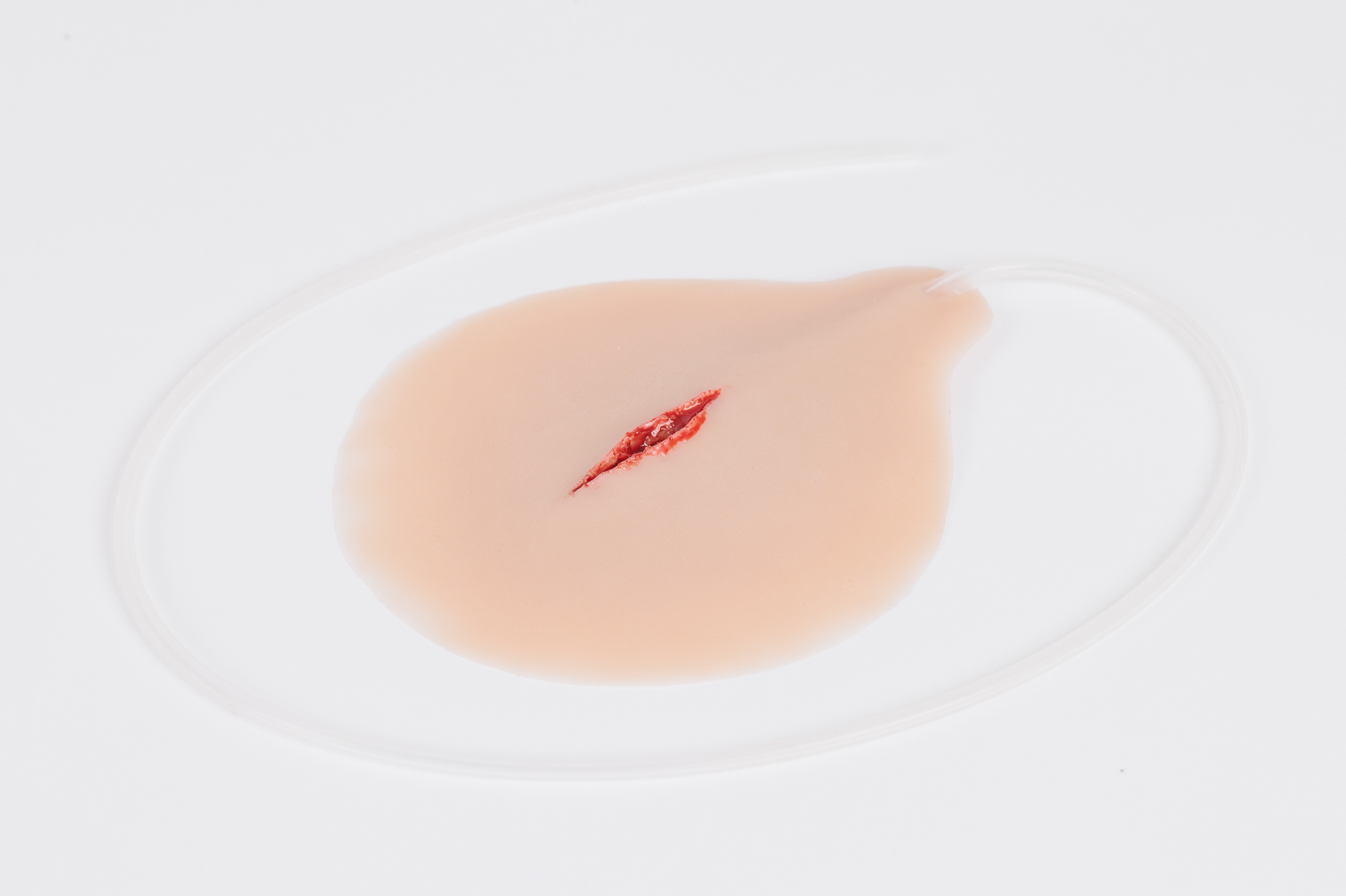 Stab Wound with Bleeding Capacity - Image 4