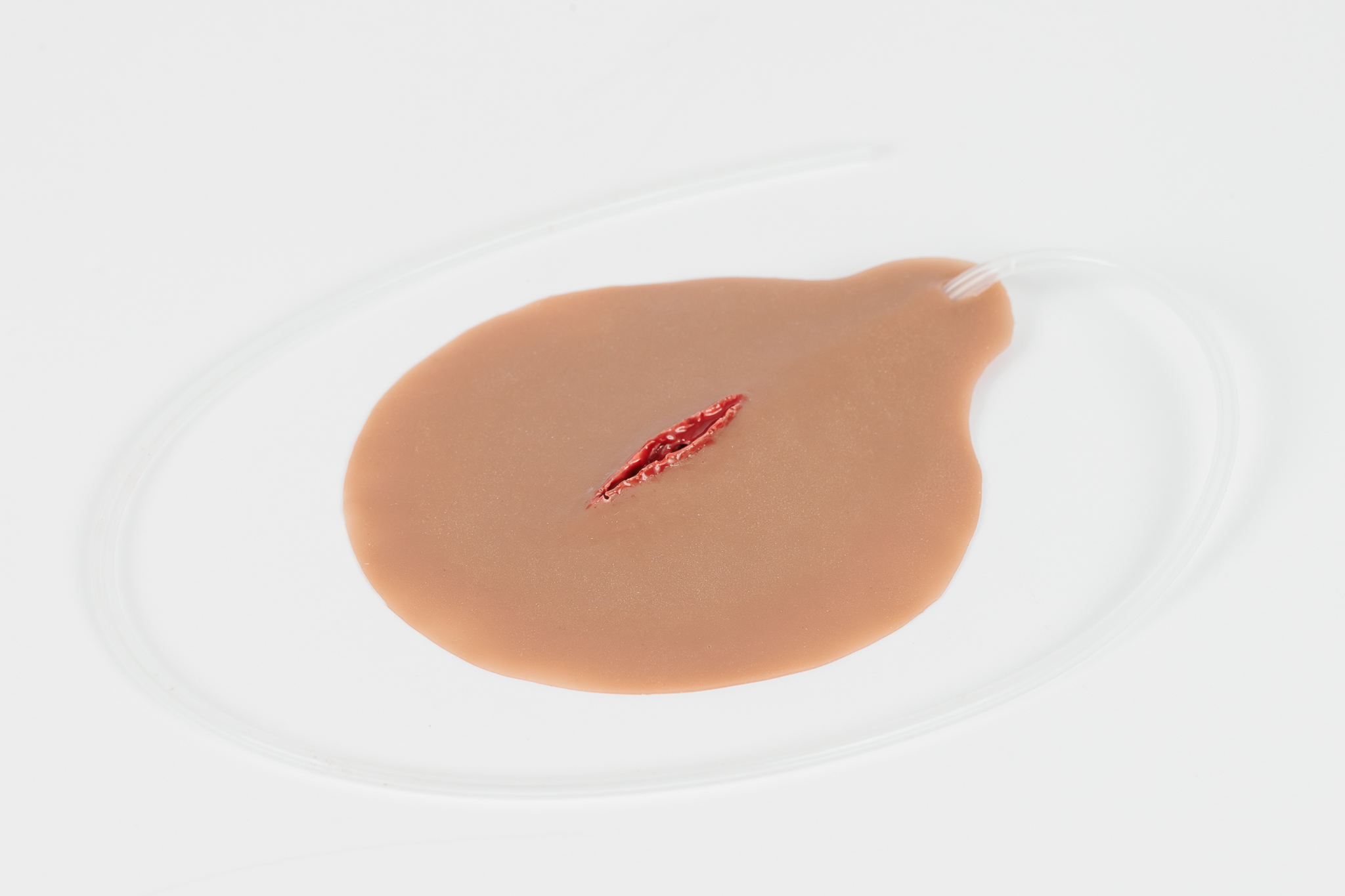 Stab Wound with Bleeding Capacity - Image 3
