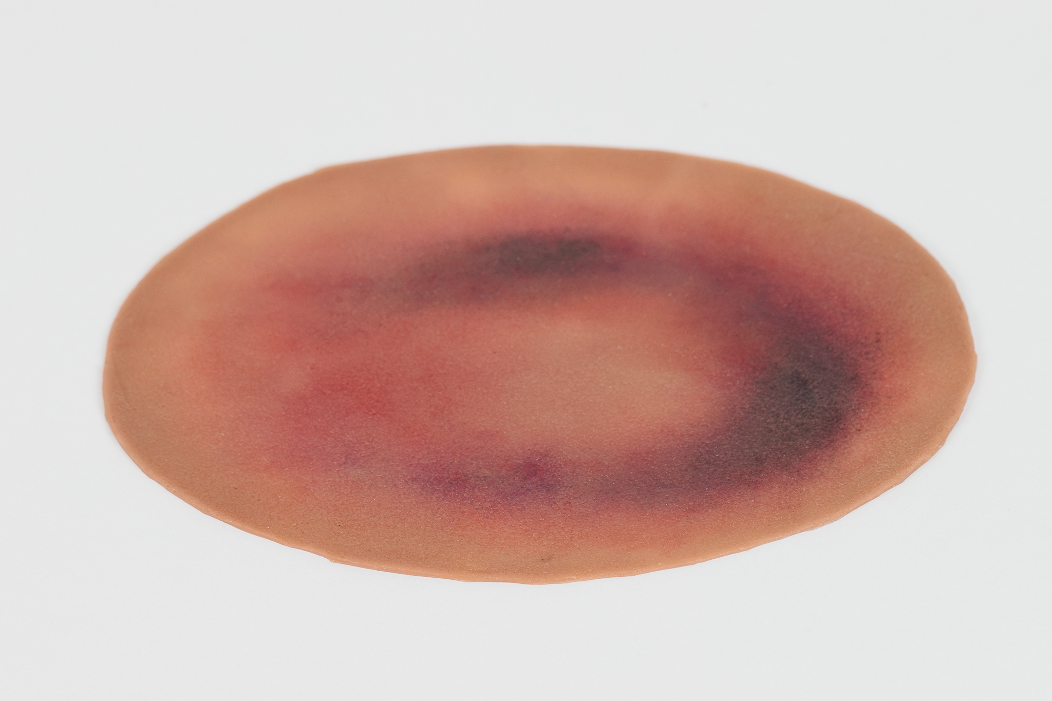 Small Haematoma - Image 3