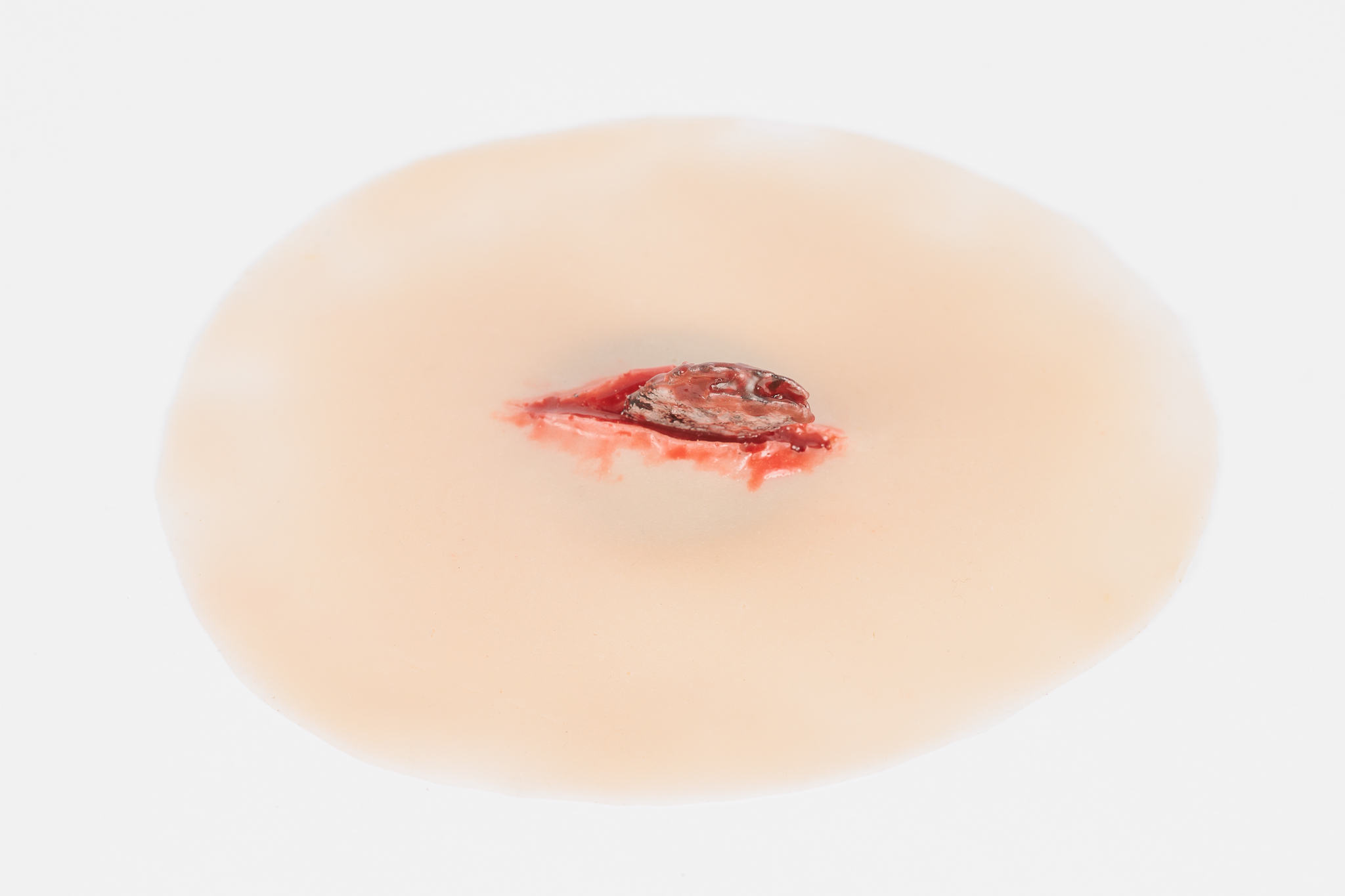 Wound with Metal Fragment - Image 7