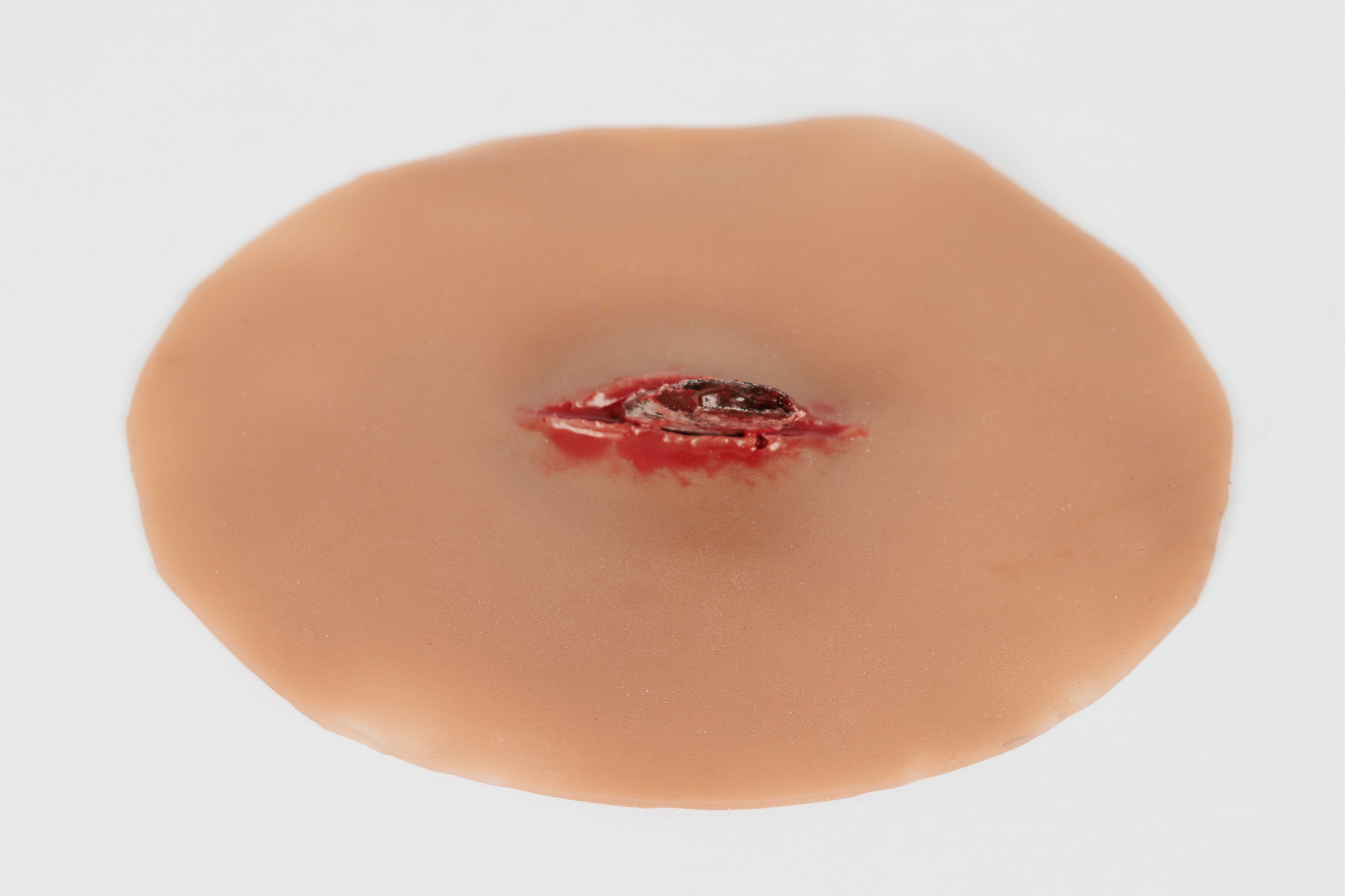 Wound with Metal Fragment - Image 8