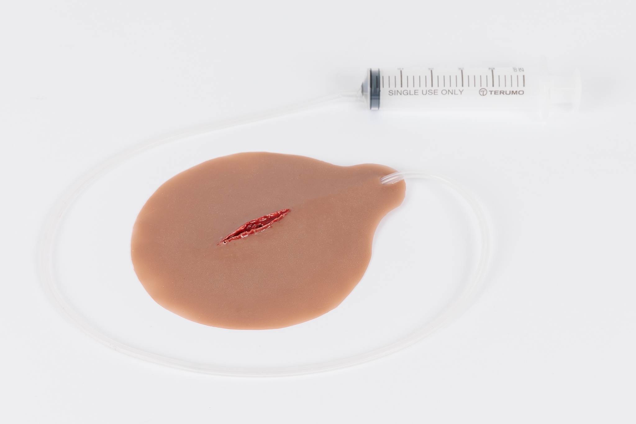 Stab Wound with Bleeding Capacity