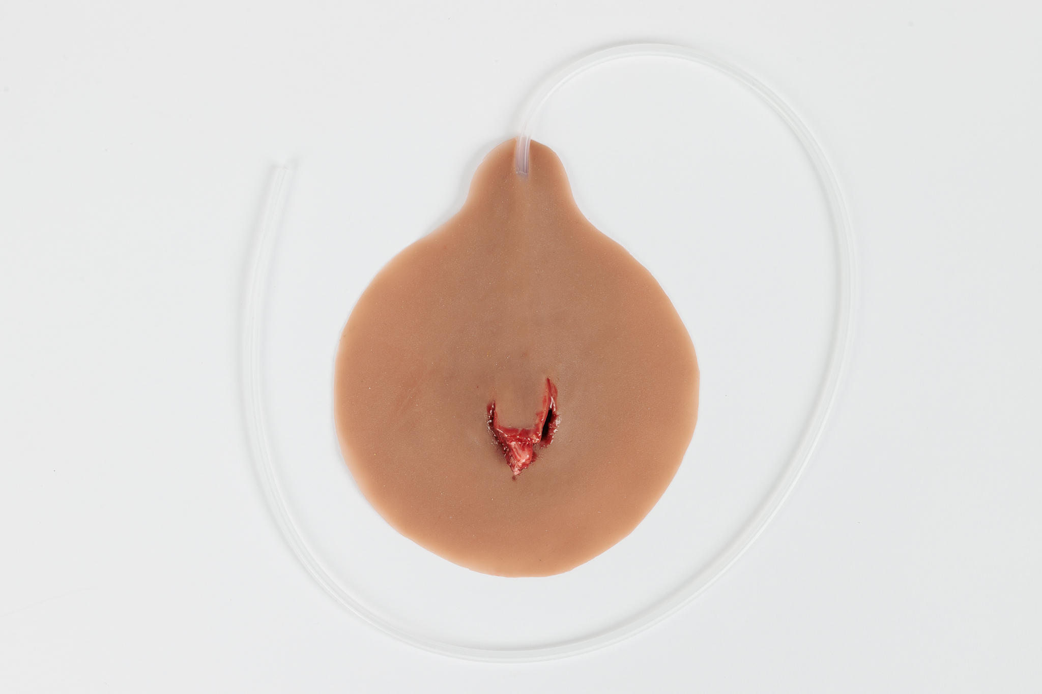 Compound Fracture Rib with Bleeding Capacity - Image 6