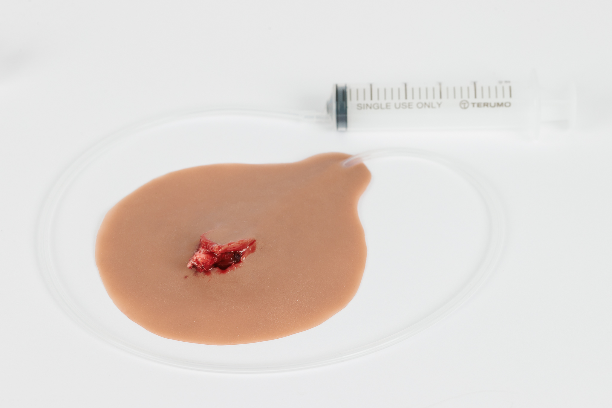 Compound Fracture Rib with Bleeding Capacity - Image 9